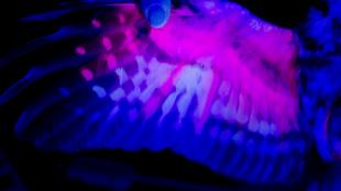 A Northern Saw-whet Owl's wing seen under UV light